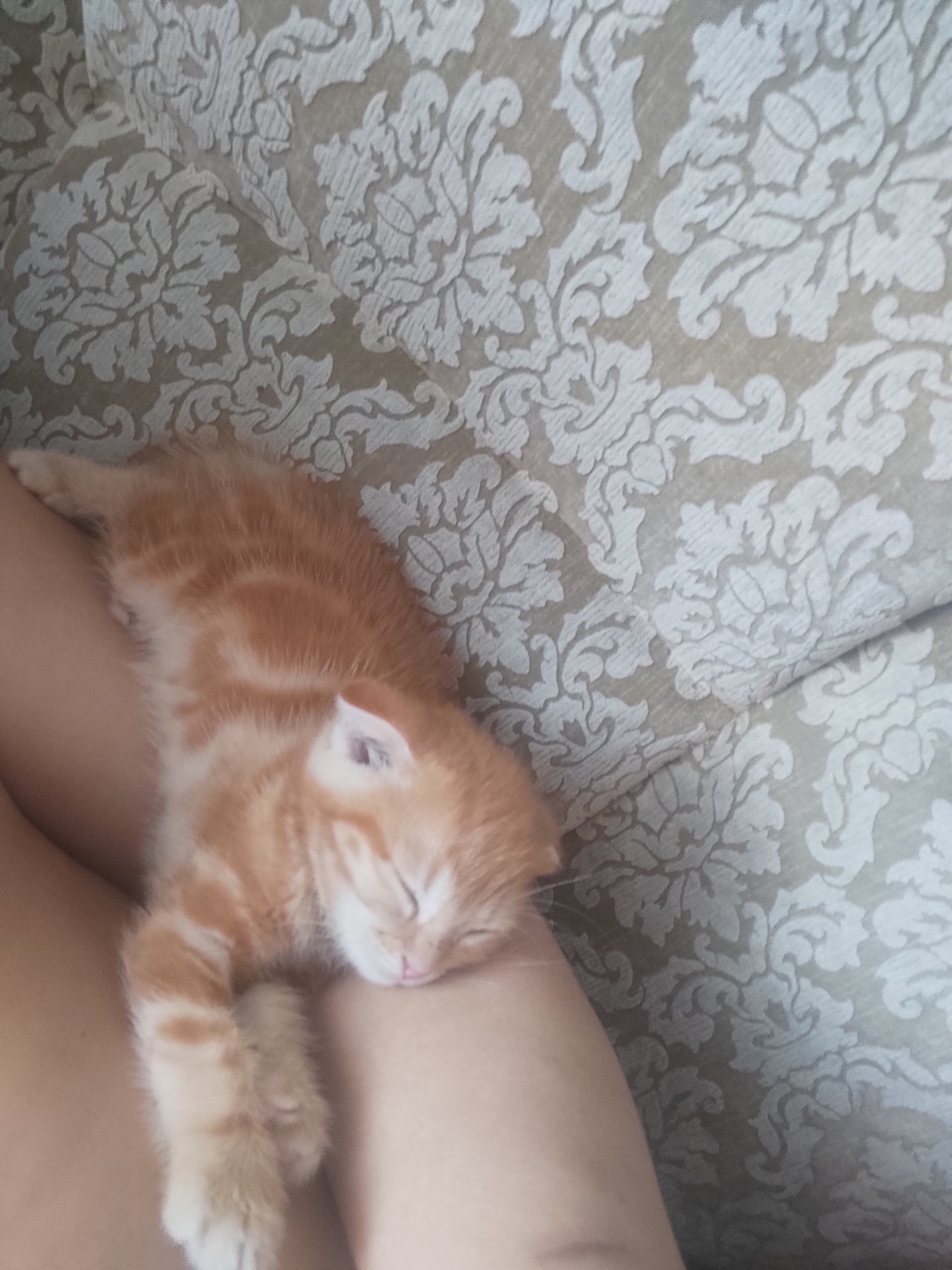 Котопаралич 1 степени
