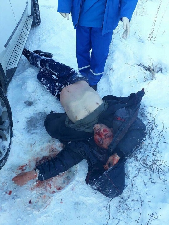 Очень мутная история из Томска где мужчина, получивший два огнестрельных ранения, забил до смерти нападавшего