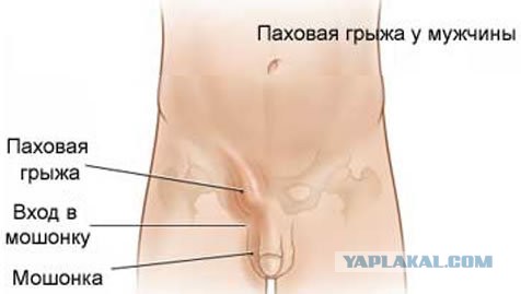 Загрузить чурку