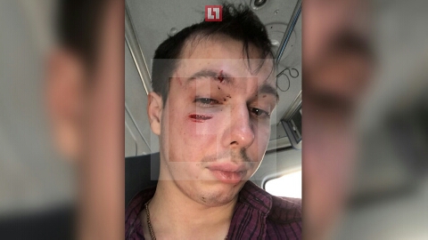 Клиента "Яндекс.Такси" избили за отказ платить наличными