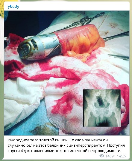 Когда люди решили прибегнуть к фотошопу, но не получилось