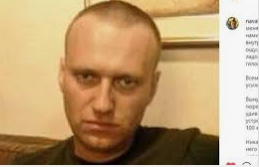 Здоровье Навального ухудшилось. Боли в спине