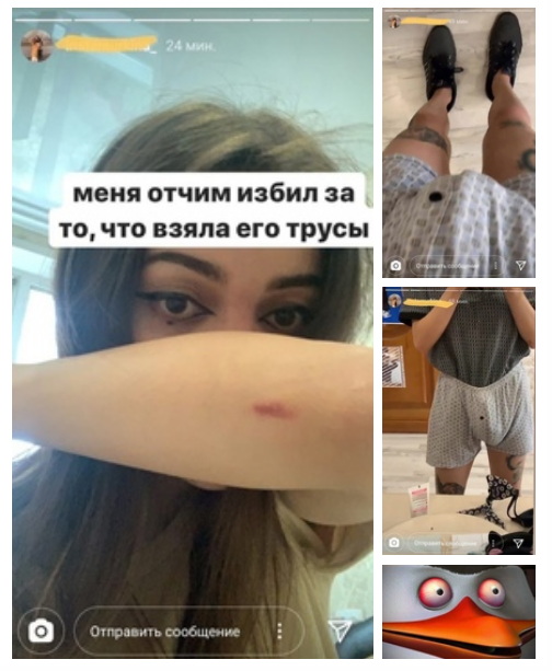 Кретинизмы из ЛМ и ЛЩ 15.03.2021