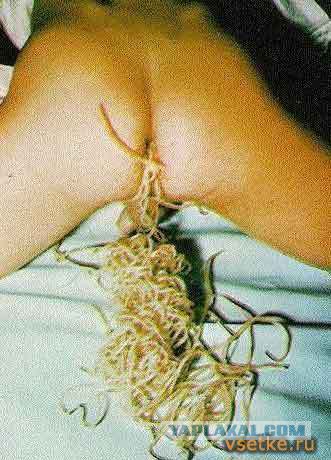 Знаете ли вы собственное дерьмо?