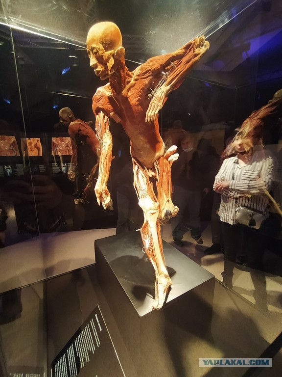 Посетил выставку Body Worlds на ВДНХ