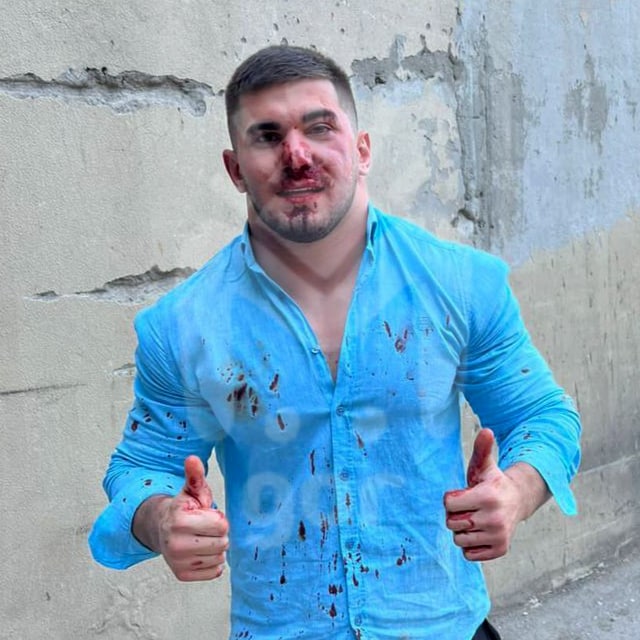 Известный блогер из Чечни Асхаб Тамаев неудачно заехал в соседний Дагестан — он получил в лицо во время конфликта в Махачкале