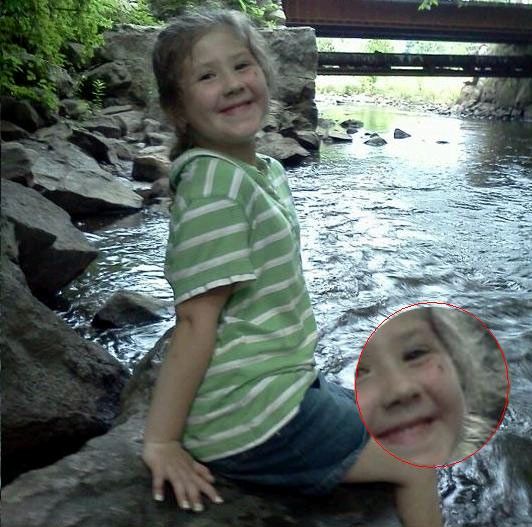 Слишком поздно заметил комара на щеке