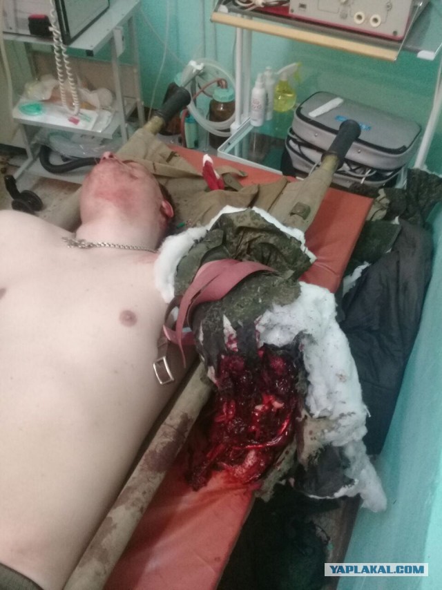 Взорвавшийся в стволе Ак-74 патрон оторвал руку офицеру на стрельбах Минобороны