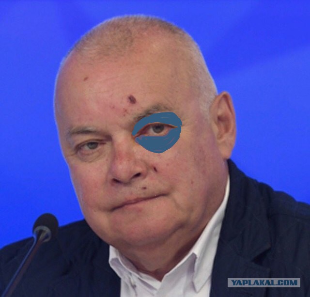 Телеведущий Дмитрий Киселев объяснил разбитое в Крыму лицо сменой имиджа, которая «отражает его позицию
