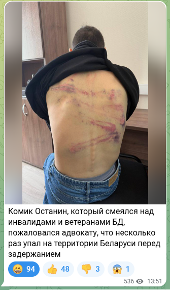 Комика Останина избили силовики.