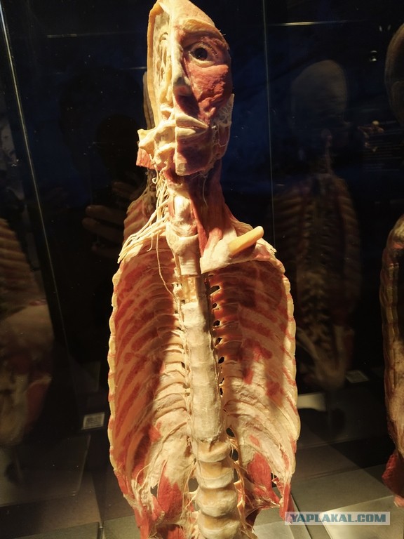 Посетил выставку Body Worlds на ВДНХ