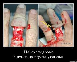 Когда погнул кольцо...