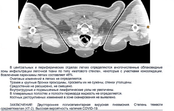 Перекличка по ковиду.