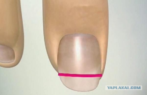 Ноготь большого пальца ноги