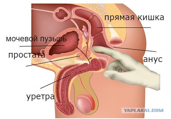 В больницу французского Тулона пришел 88-летний дедушка, который пожаловался на снаряд времен Первой мировой войны, который... застрял у него в жопе