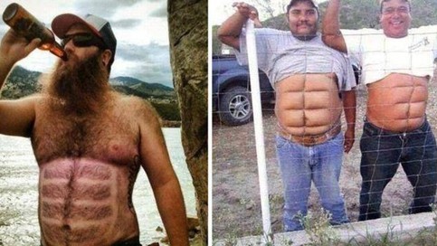 Накладные плечи: в Москве мужчины стали массово увеличивать мышцы в клиниках красоты