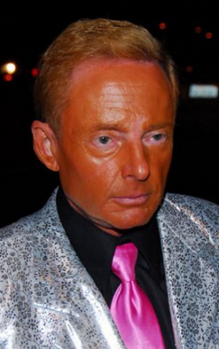 Люди, переборщившие с загаром