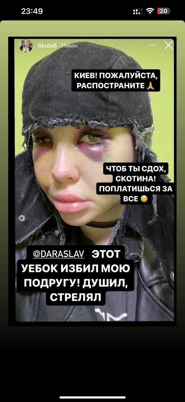 Парень узнал что его любимая изменила ему в клубе с турком и вот что из этого вышло.....
