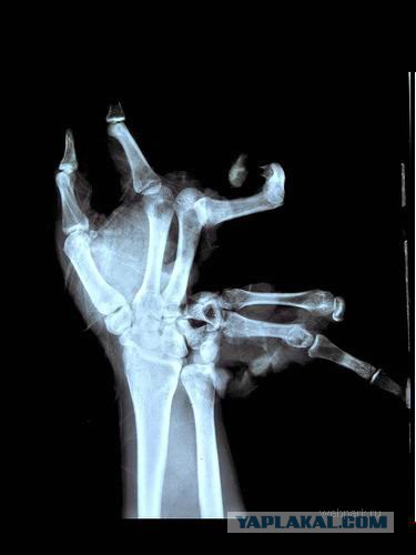 Суровое детство