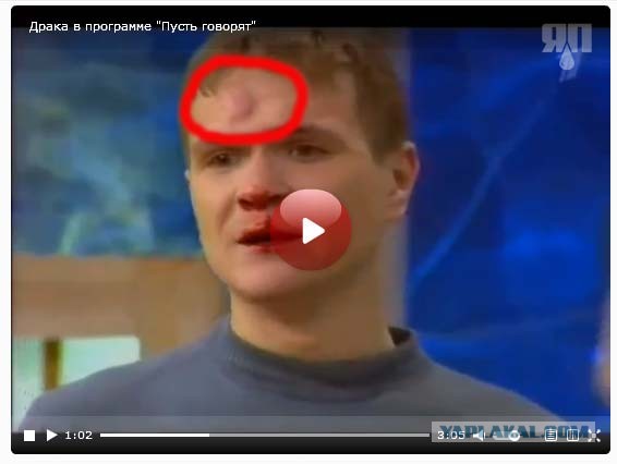 Драка в программе "Пусть говорят"