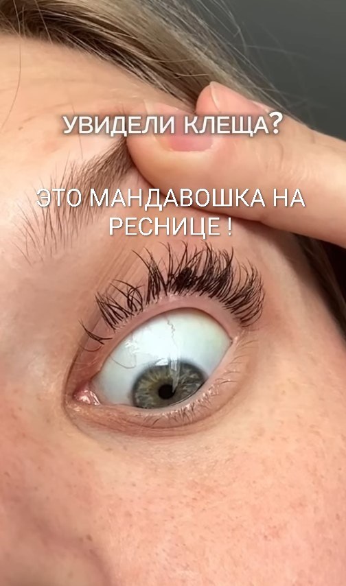 Картинки для деградации 198 (разной степени свежести)