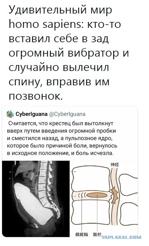 Дизайнера доставили в московскую больницу с огурцом в кишечнике
