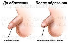 Что это такое?