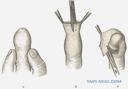 Зачем в иудаизме и исламе делают обрезание