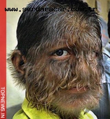 Девайс для лысеющих...