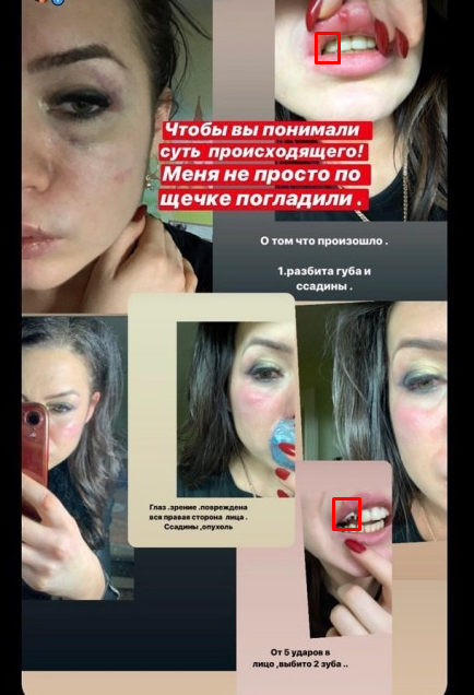 В Ярославле мужчина-боксер в кальянной набросился на девушку