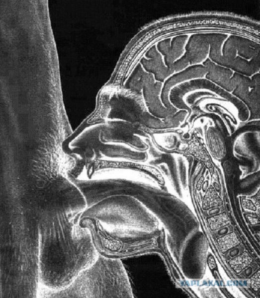 Художник запечатлел процесс секса в рентгеновских лучах