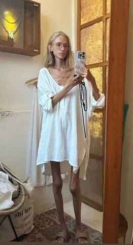 На Бали от истощения умерла женщина из Польши