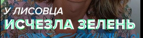 Что за дерзкие "неизвестные". Нужно свою акацию на сигналку поставить)