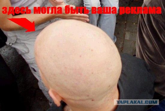 Фотожаба: лысая бошка