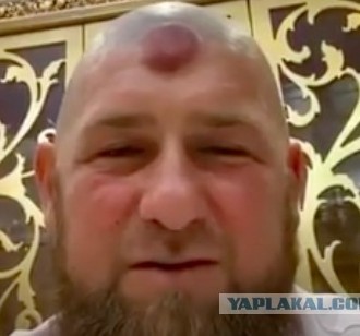 Стало известно о тяжелом состоянии Кадырова