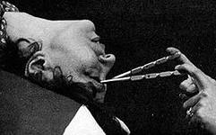 Кошмарные инструменты эскулапов