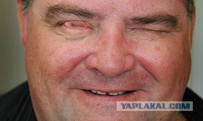 Видеть при помощи зуба? легко!