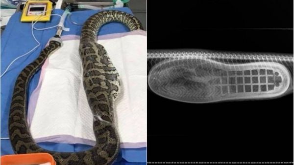 16 снимков человеческого тела, которые нельзя сделать обычным фотоаппаратом