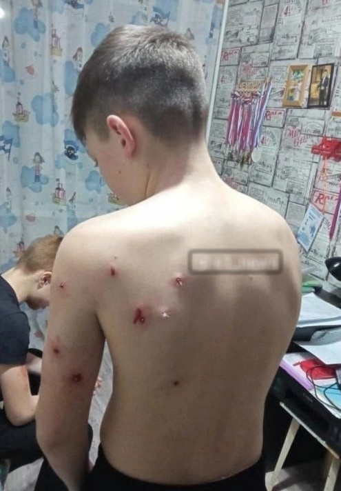 На Урале пожилой мужчина выстрелил из ружья в регулярно мучивших его подростков