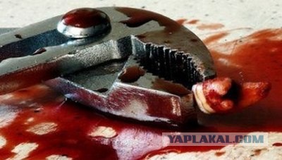 Вырвали сыну молочный зуб