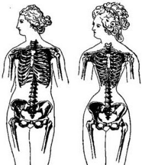 История женского корсета