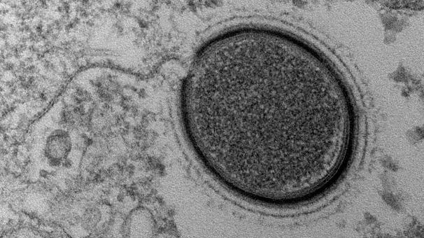 Ученые планируют пробудить 30 000-летний вирус