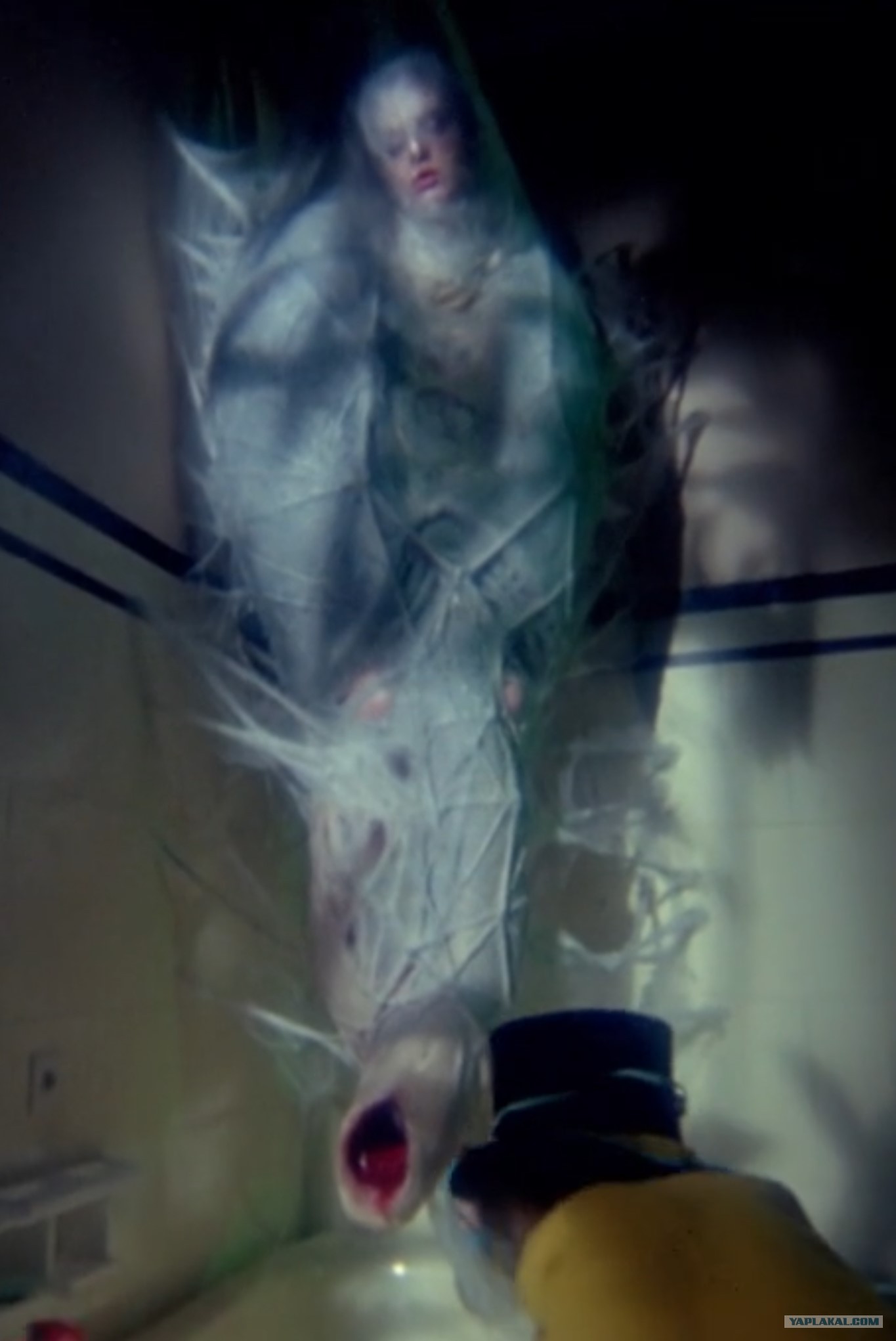 Стоимость Пересадки Матки