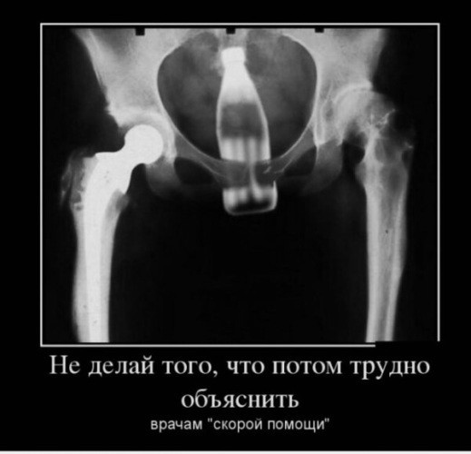 Абсолютно правдивый несчастный случай, который может случиться с каждым
