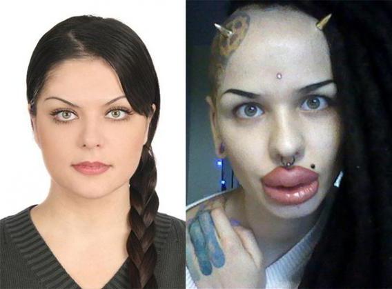 10 худших пластических операций знаменитостей