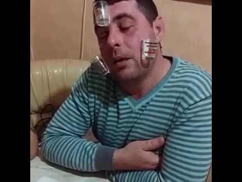 Скитлскулёз