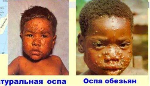 Пандемия. Коронавирус и съехавшие крыши. Россия и мир. Часть 35