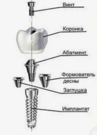 Крошке прикрутили зубы, и у неё поменялась жизнь