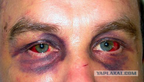 Мама возмущена: Великий пост, а детей в школах кормят пиццей и сосисками