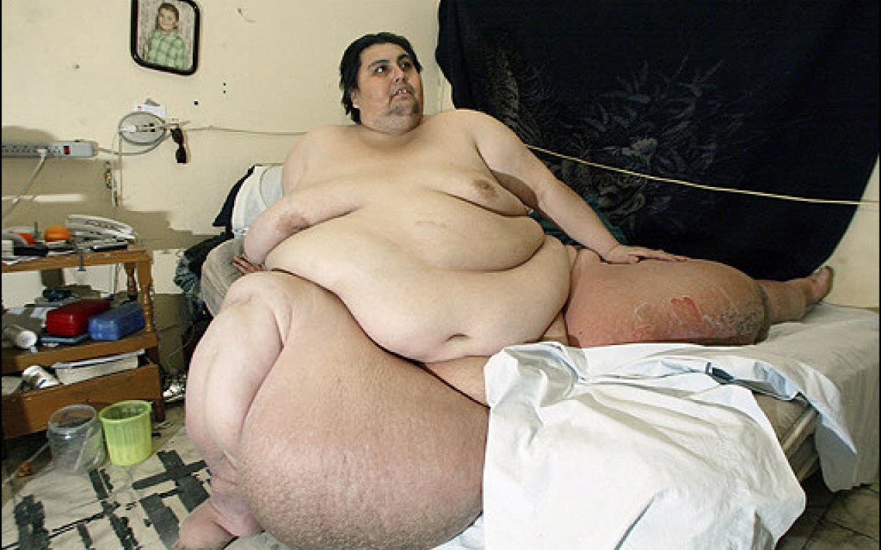 Fattest human alive